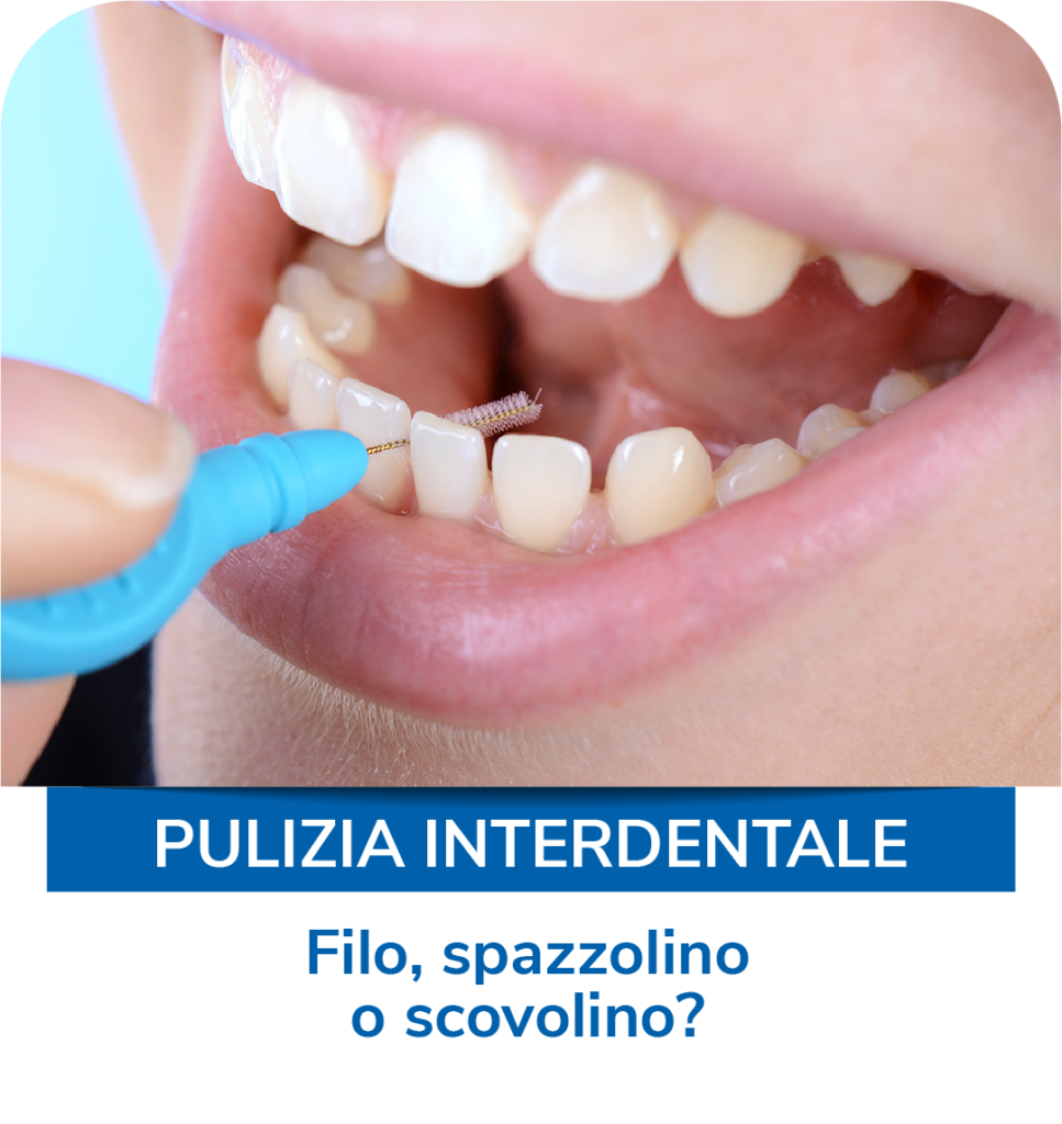 Pulizia interdentale