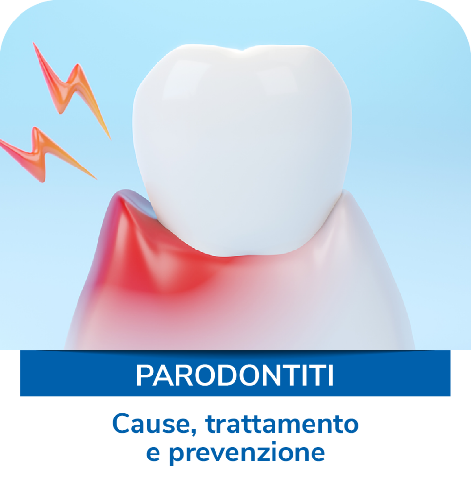 parodontiti cause